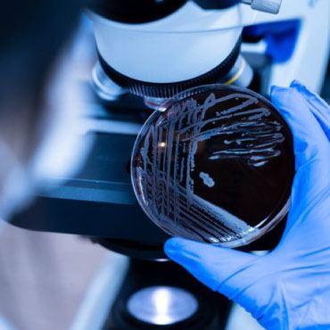 A close-up of a person in blue gloves holds a petri dish of bacteria under a microscope