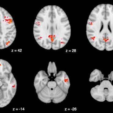 Six brain scans that show exposure to traffic pollution